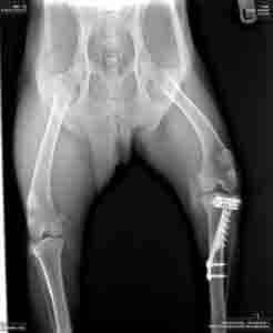 Veterinary Surgery - Animal X-ray Front View in Seattle, WA X-ray of dog's hindquarters. Right leg shows a healed fracture with a metal plate and screws.