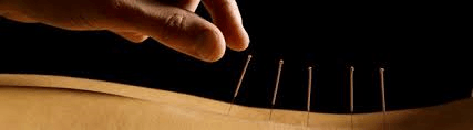 Geelong dry Needling Services