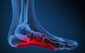 Foot Pain