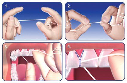 Tooth Colored Fillings - Christiana Pleasant Dental