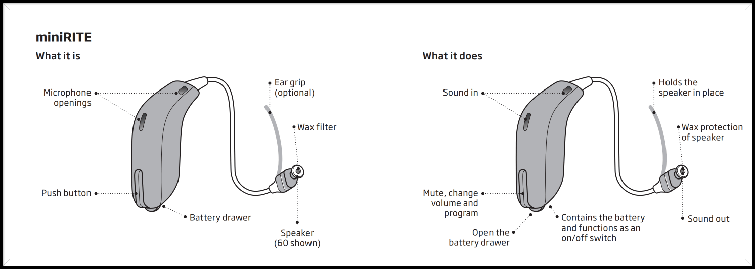 Black-and-white side-view diagrams comparing two labeled ear/helmet-like shapes with measurements and arrows