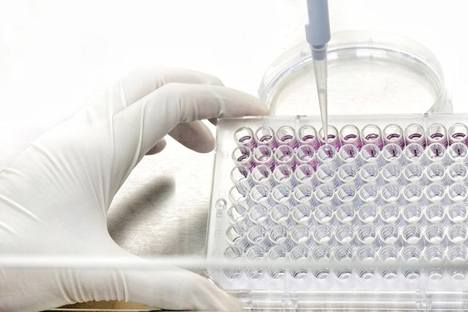cytotoxic test
