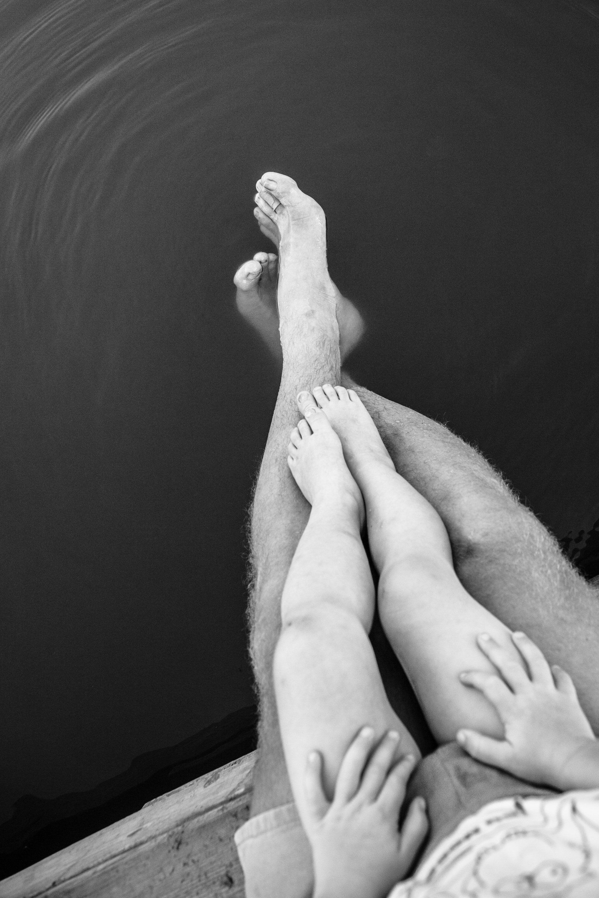 Father and baby legs after varicose vein treatment