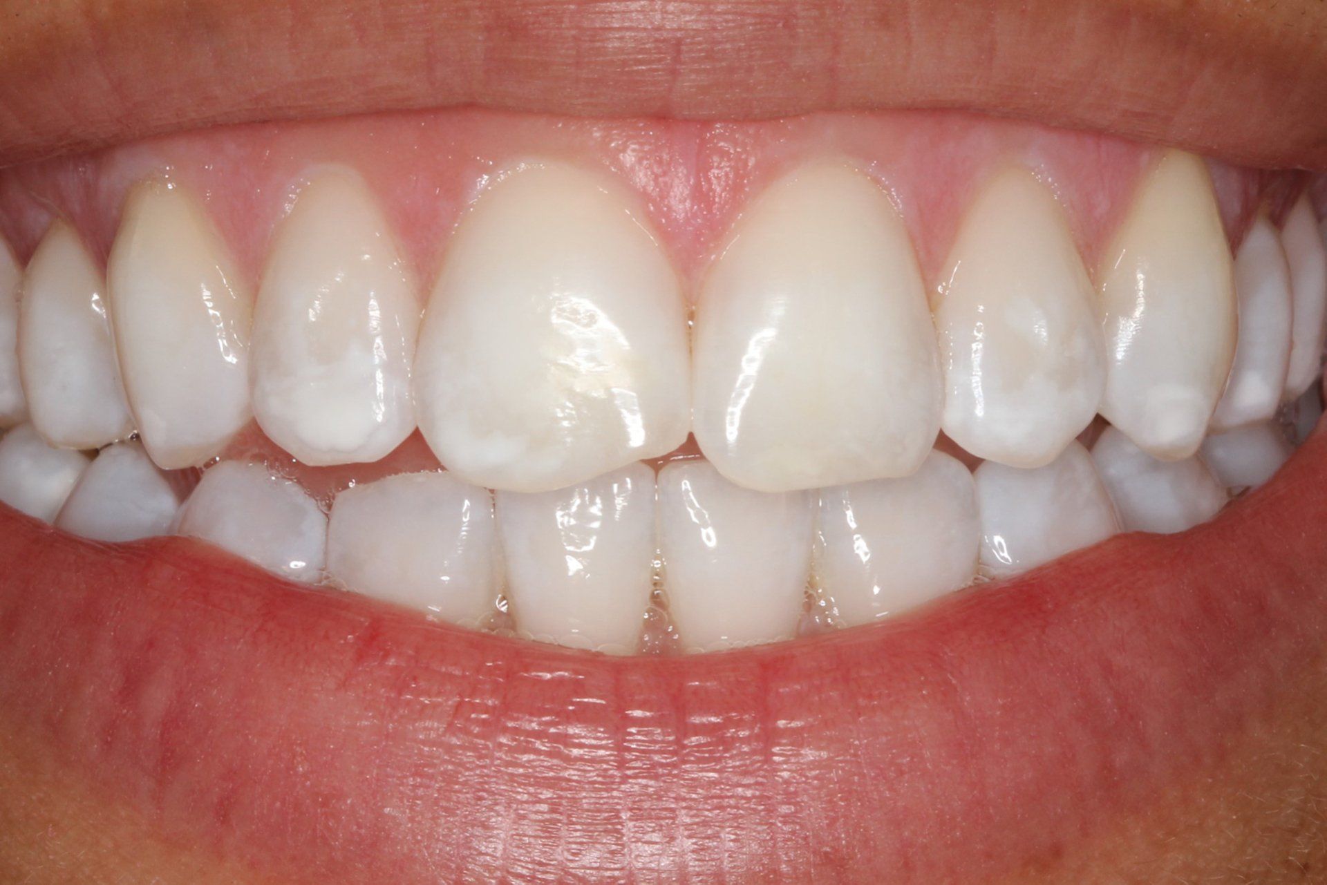 Cosmetic Treatment