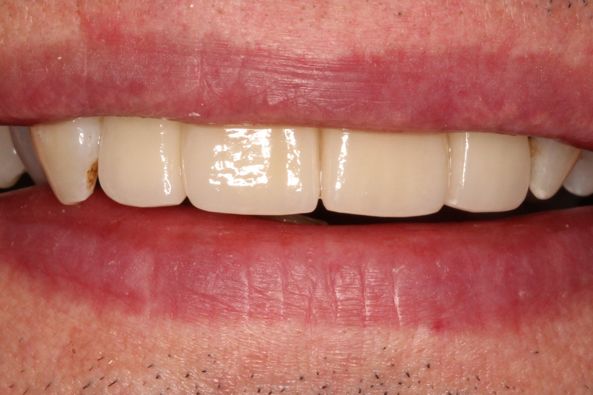 Cosmetic Treatment