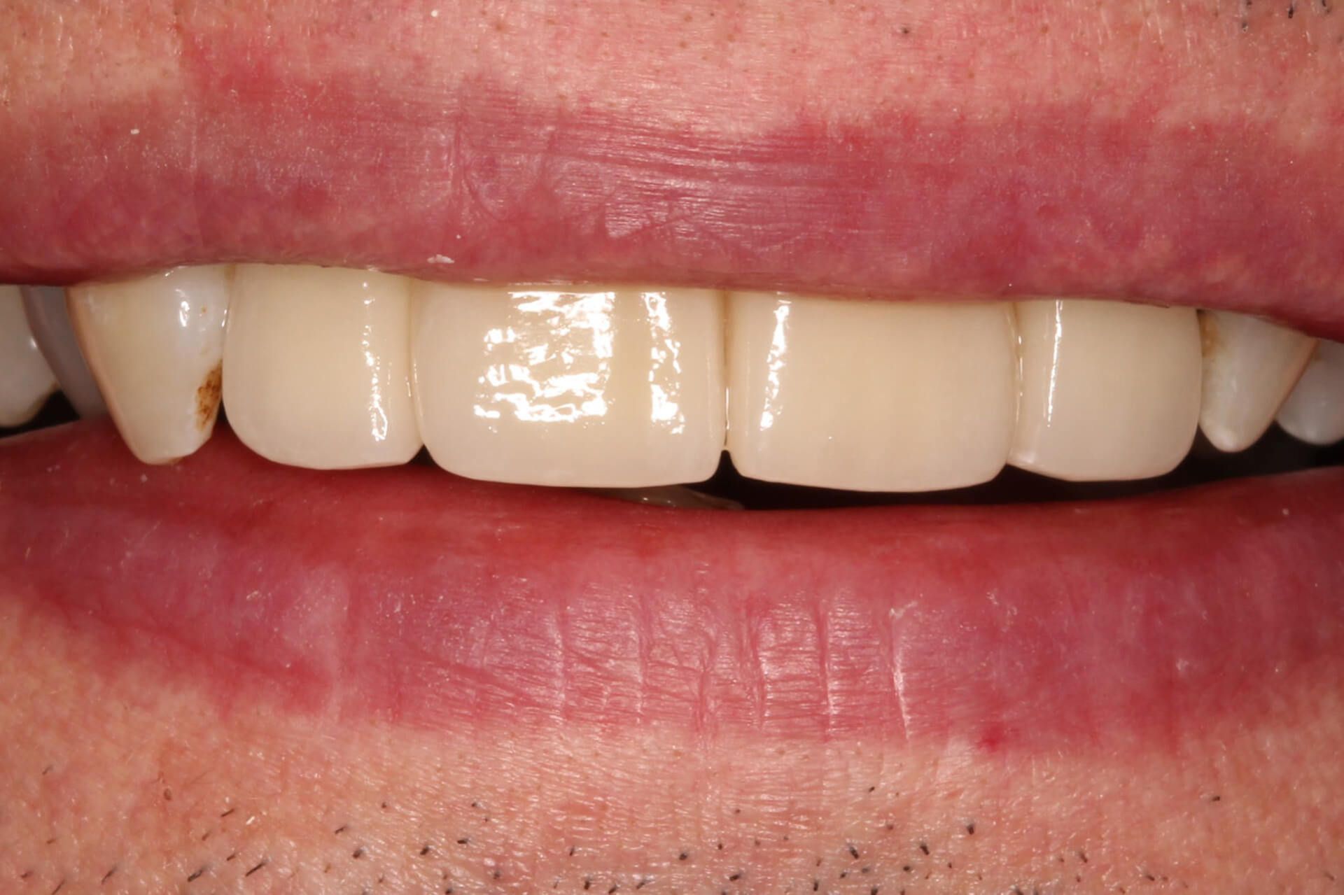 Pall Mall Dental