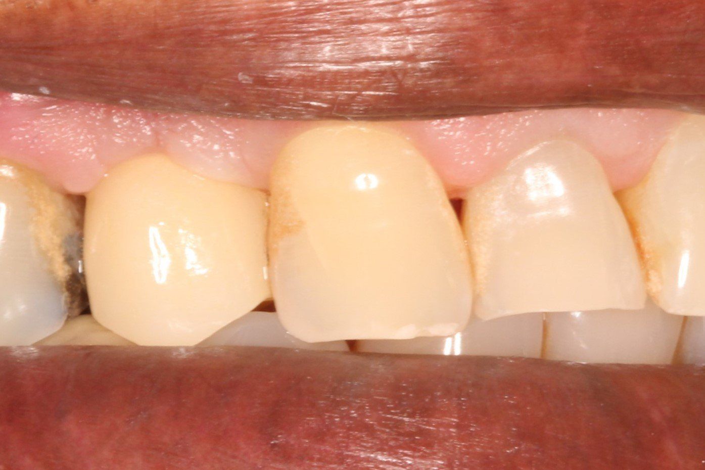 Pall Mall Dental
