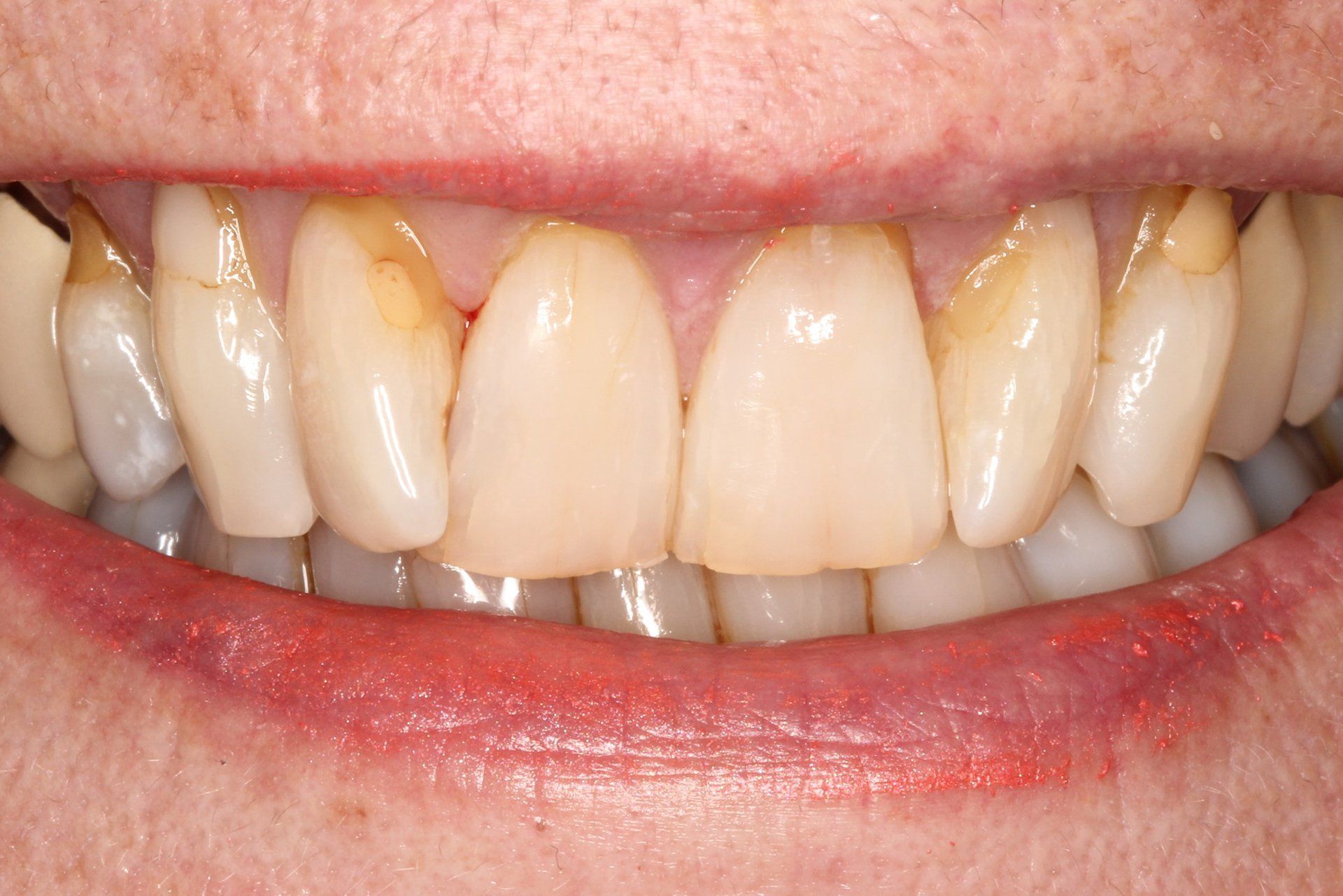 Cosmetic Treatment
