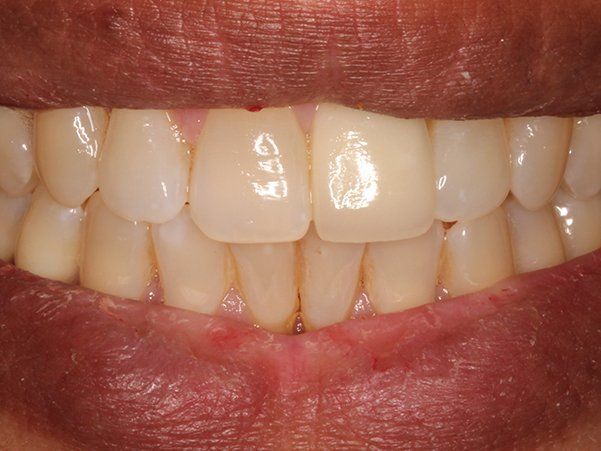 Cosmetic Treatment