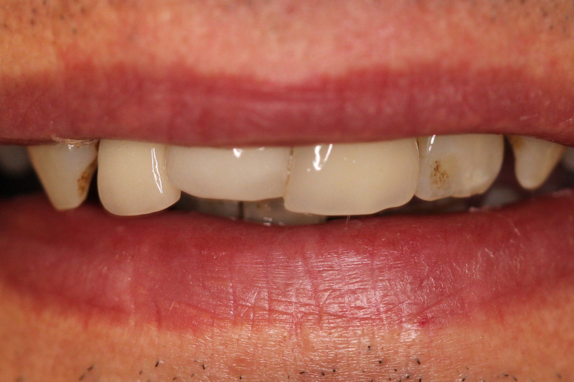 Cosmetic Treatment