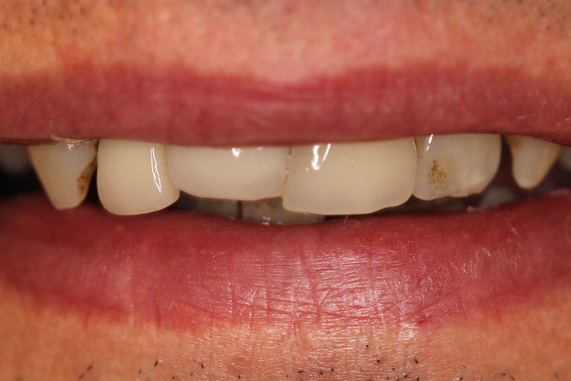 Pall Mall Dental