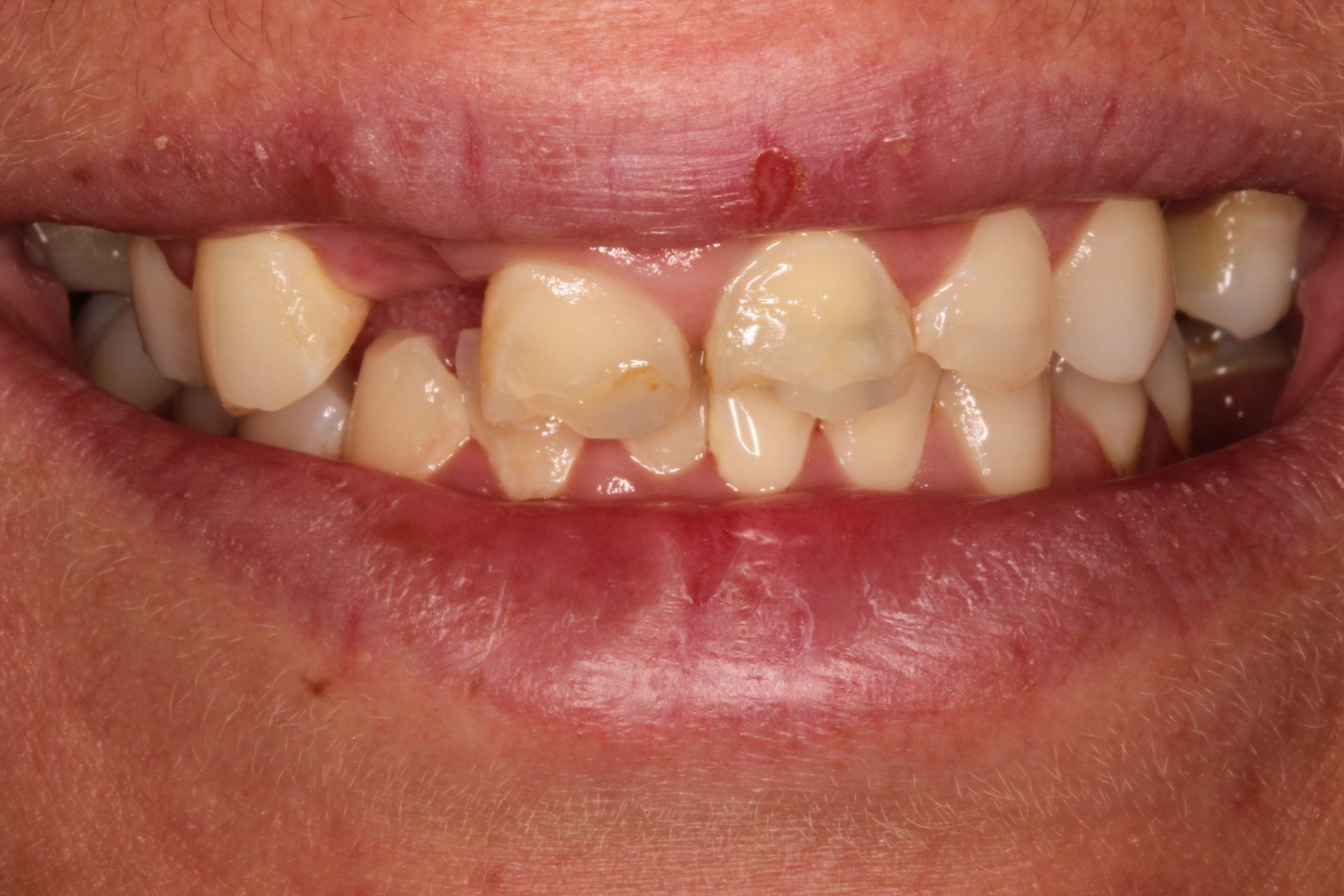 Pall Mall Dental
