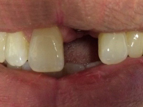 Cosmetic Treatment