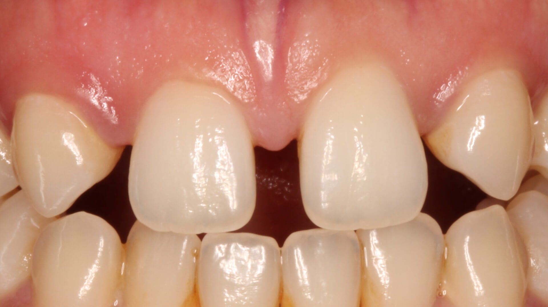 Pall Mall Dental