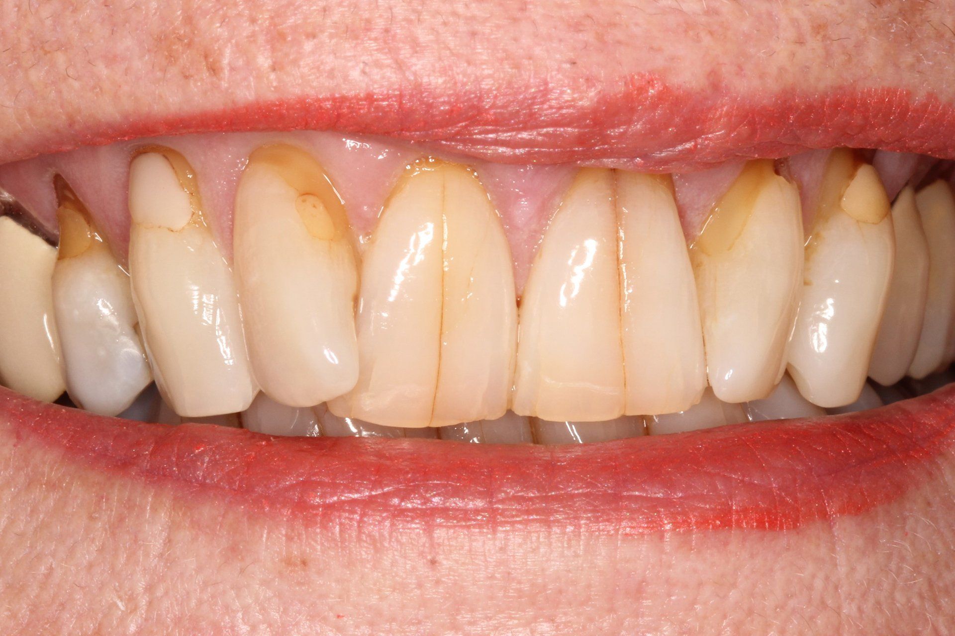 Cosmetic Treatment