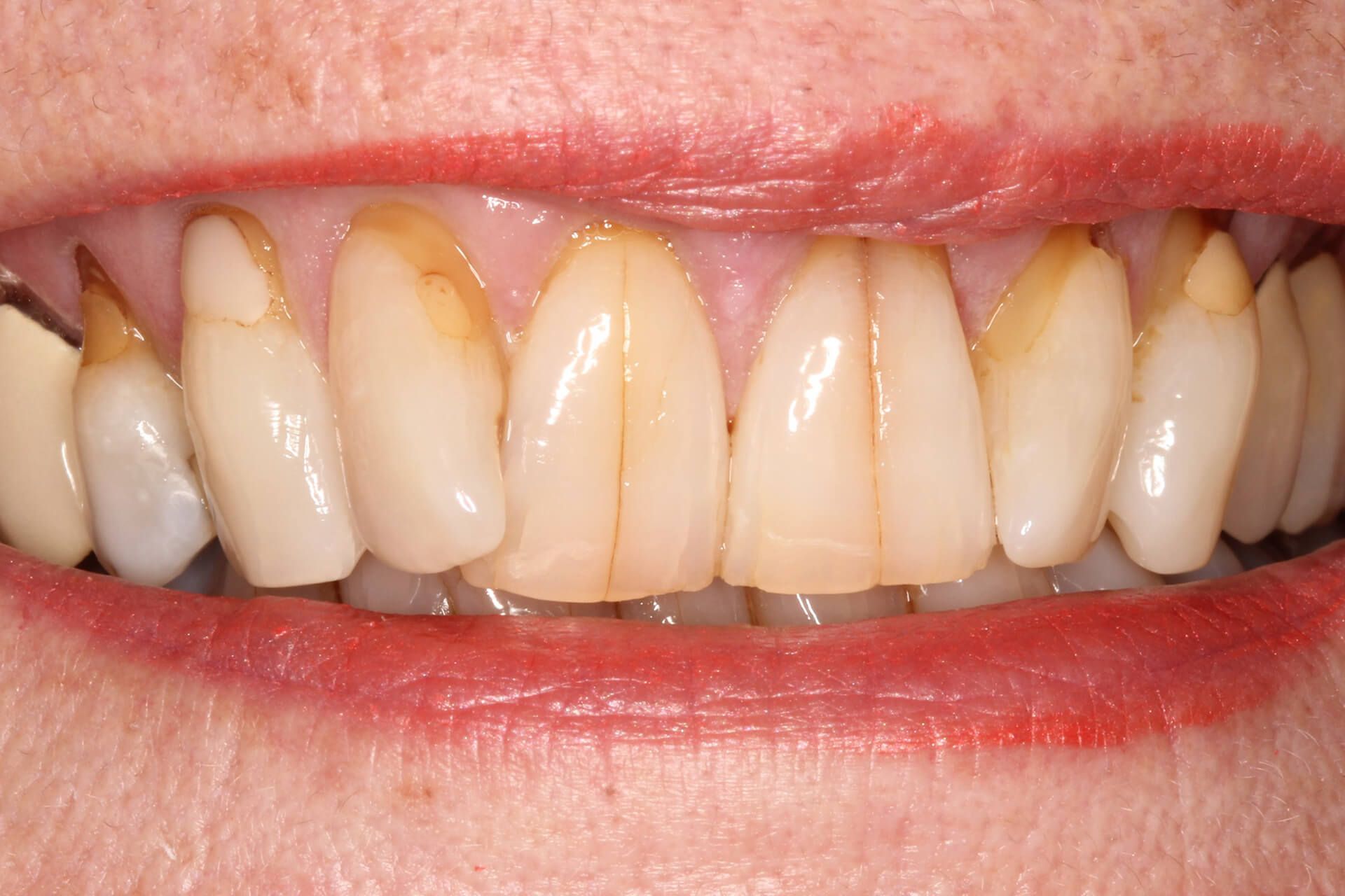 Pall Mall Dental