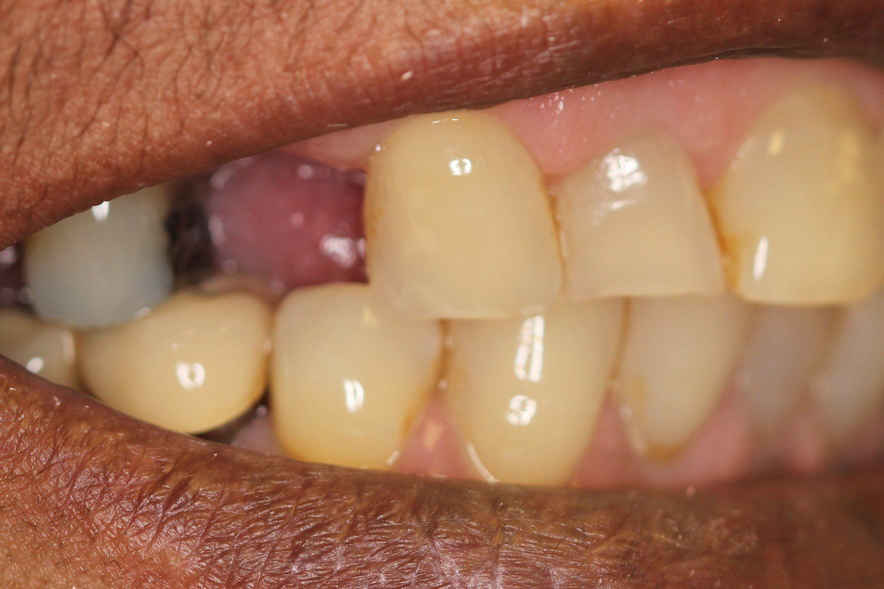 Pall Mall Dental