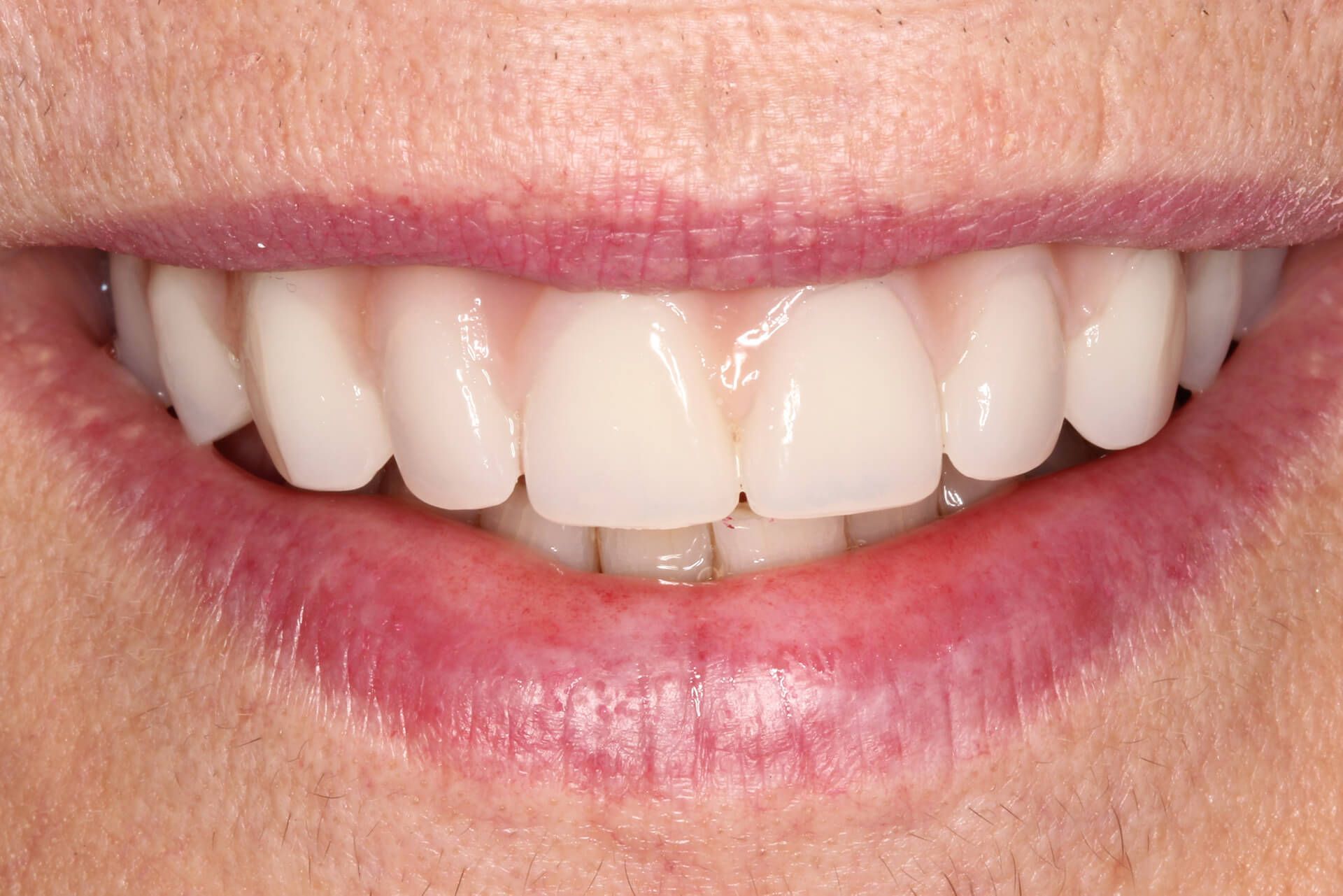 Pall Mall Dental
