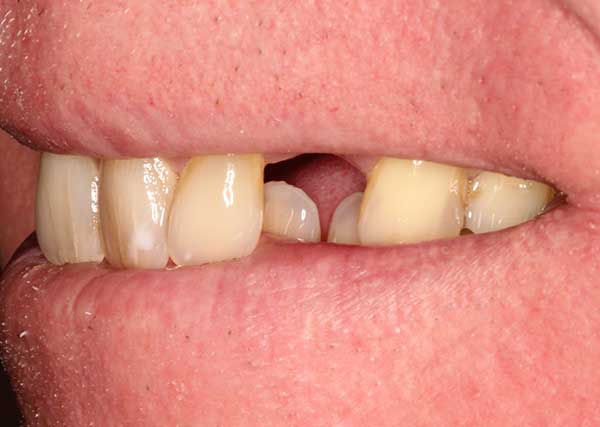 Pall Mall Dental