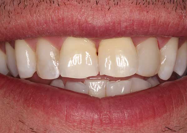 Pall Mall Dental