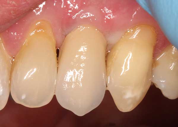 Pall Mall Dental