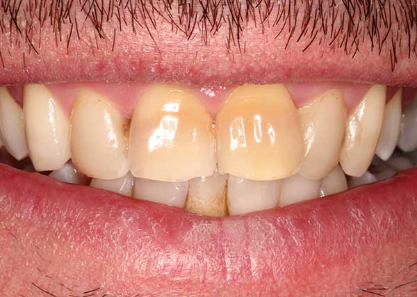 Pall Mall Dental