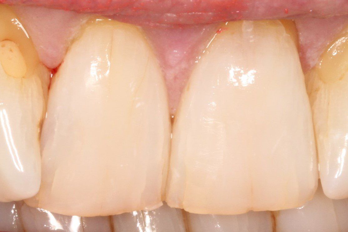 Pall Mall Dental