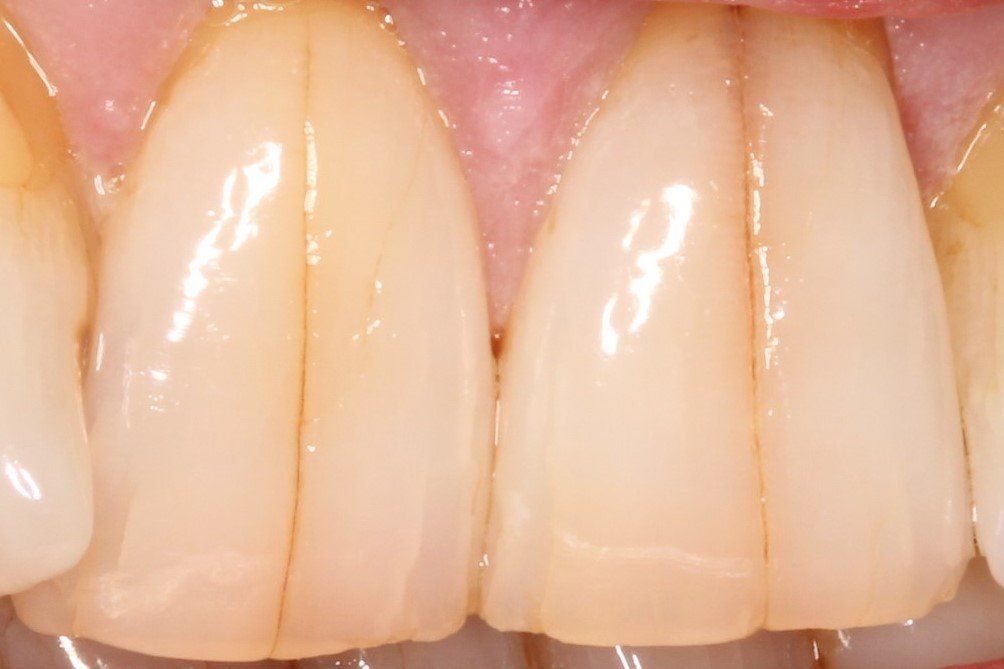Pall Mall Dental