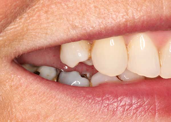 Pall Mall Dental