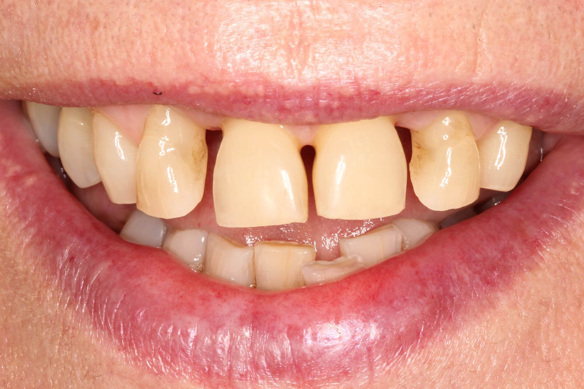 Pall Mall Dental