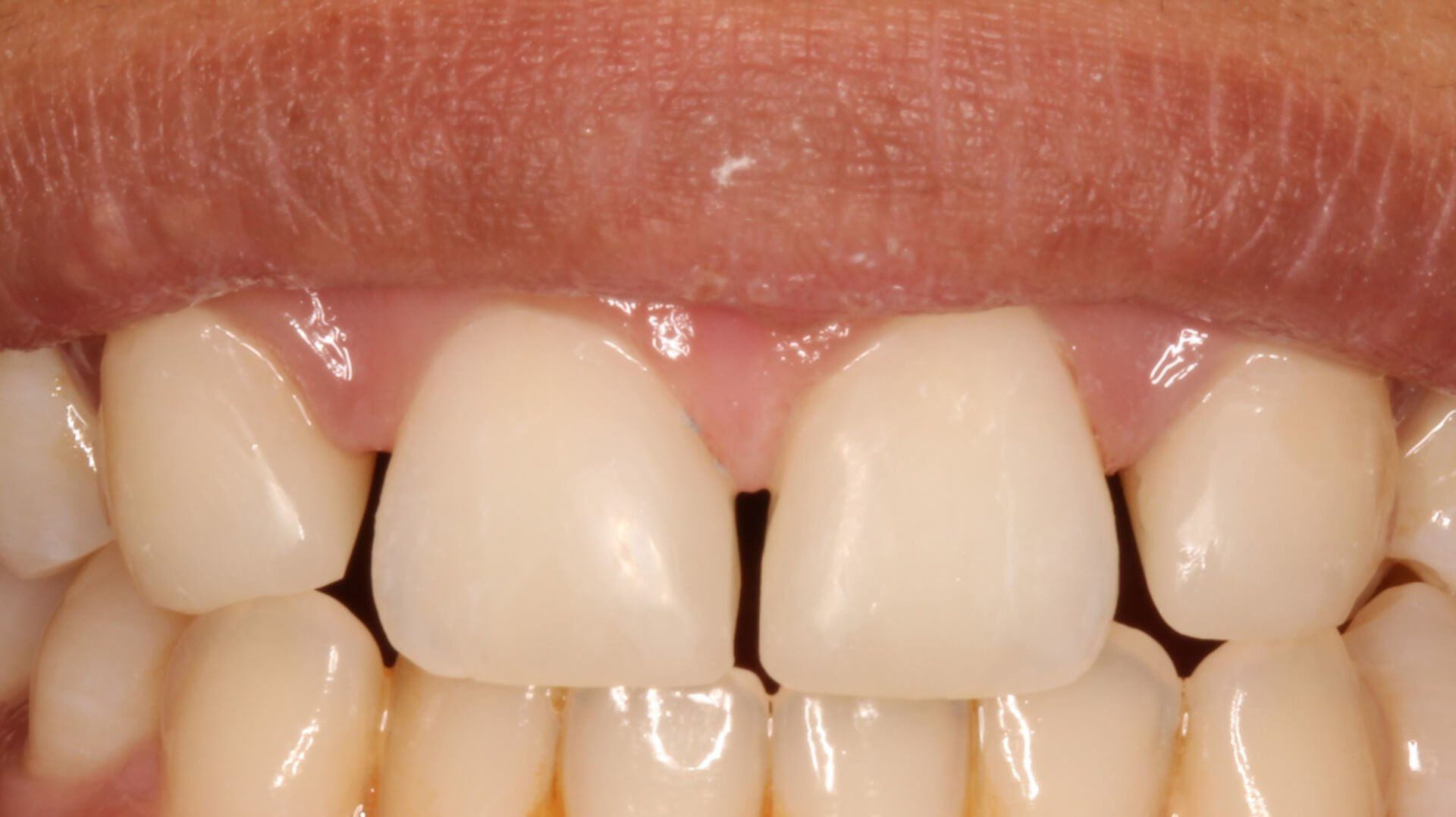 Pall Mall Dental