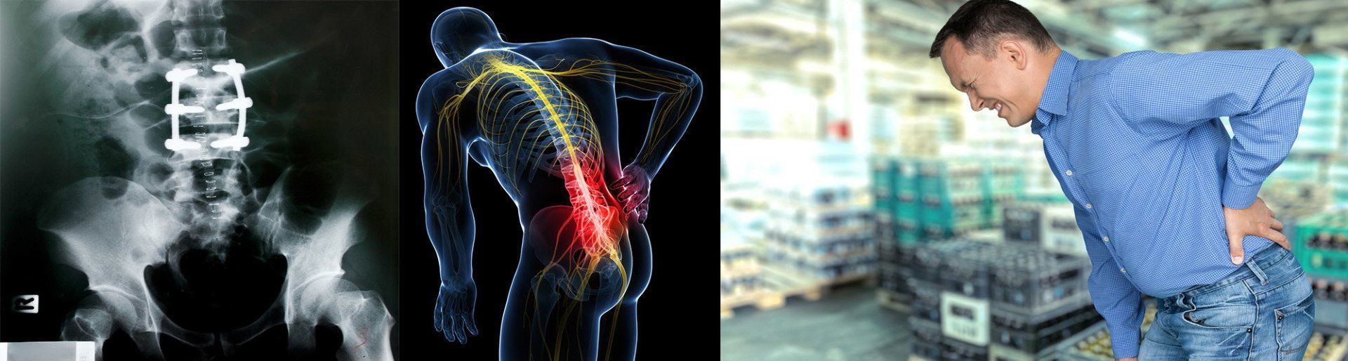 Work Injury Claim - Matt Mathews is Protecting Alabama Workers