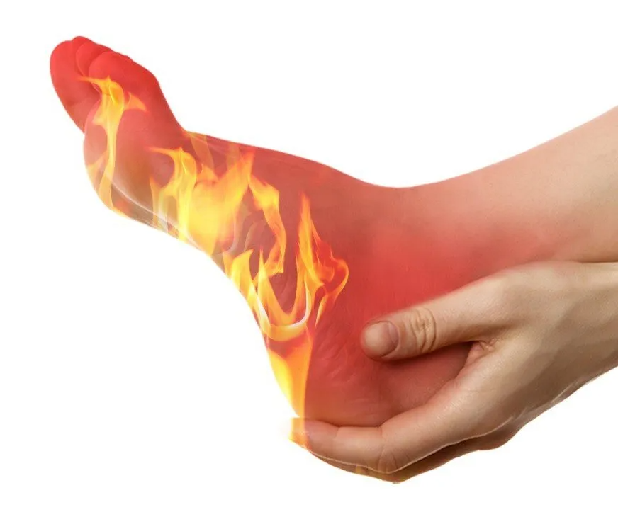 Burning Nerve Pain Burning Foot Pain
