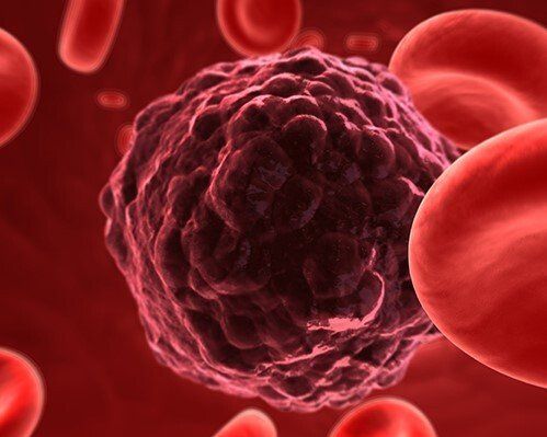 Chemo Nerve Damage Chemo Induced Neuropathy