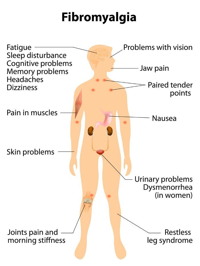 Click to Enlarge Common Symptoms of Fibromyalgia by Fibromyalgia Massage Therapist Eugene Wood, Located in Wantagh NY 11793, and Massapequa NY 11758