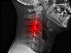 The Health Benefits of CranioSacral Massage Therapy