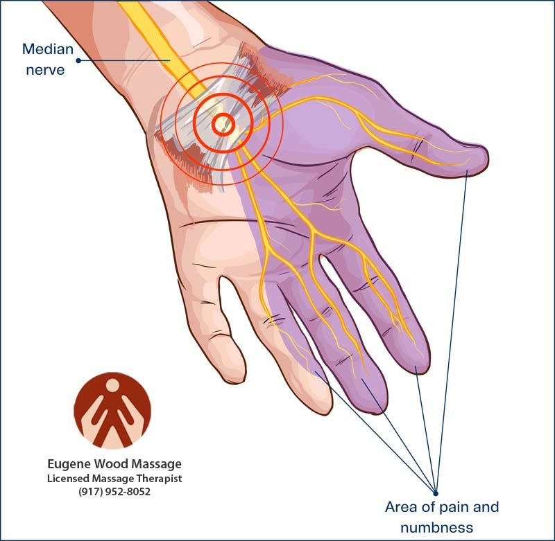 Click to Enlarge Massage Therapist for Carpal Tunnel Eugene Wood, Located in Wantagh NY 11793, and Massapequa NY 11758