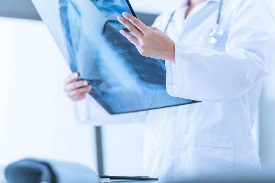 Analisi radiografia