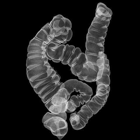 Colonscopia