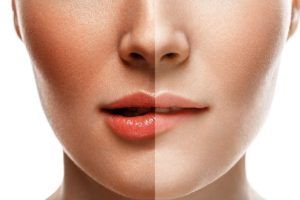 Woman with Half Dark Half Light Skin — Scottsdale, AZ — XanderLyn Salon Woman with Half Dark Half Light Skin — Scottsdale, AZ — XanderLyn Salon