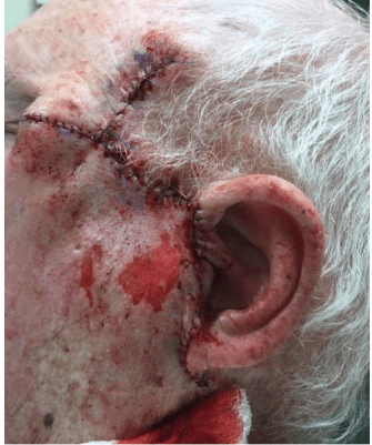 Case of the Month | January | Pine Belt Dermatology