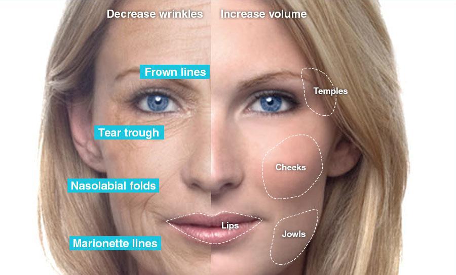Skin Tightening | Pine Belt Dermatology