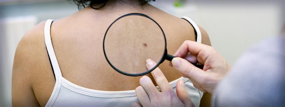General Dermatology | Pine Belt Dermatology