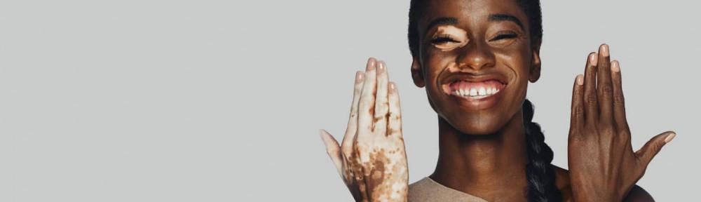 Skin Discoloration | Pine Belt Dermatology