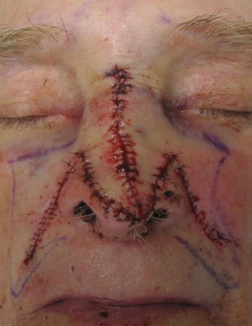 Skin Conditions | Pine Belt Dermatology