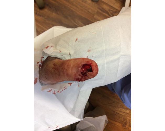 February 2020 | Nail Repair | Pine Belt Dermatology