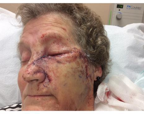 Case of the Month March 2020 | Pine Belt Dermatology