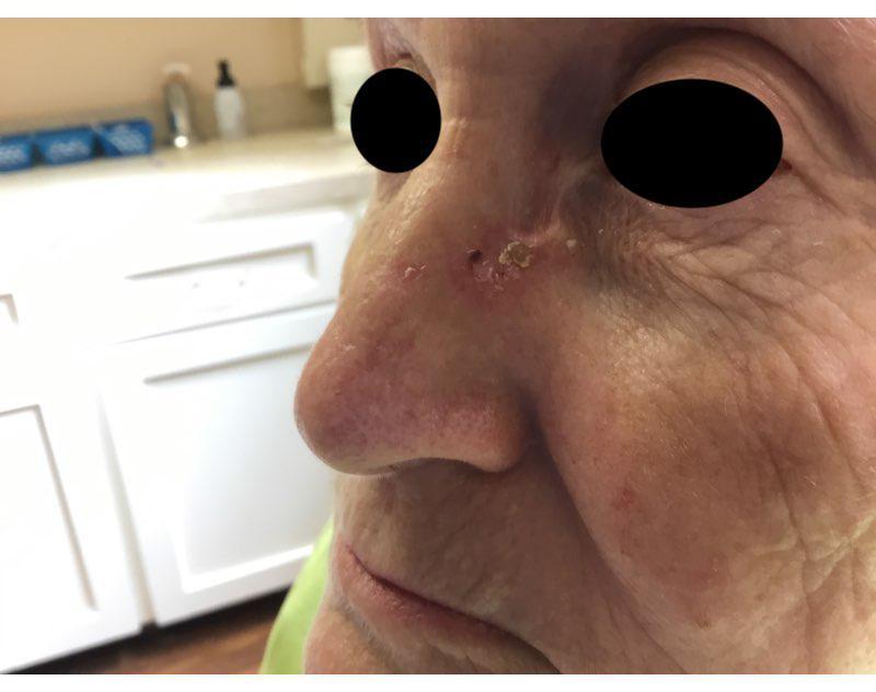 Finding the problem | Pine Belt Dermatology