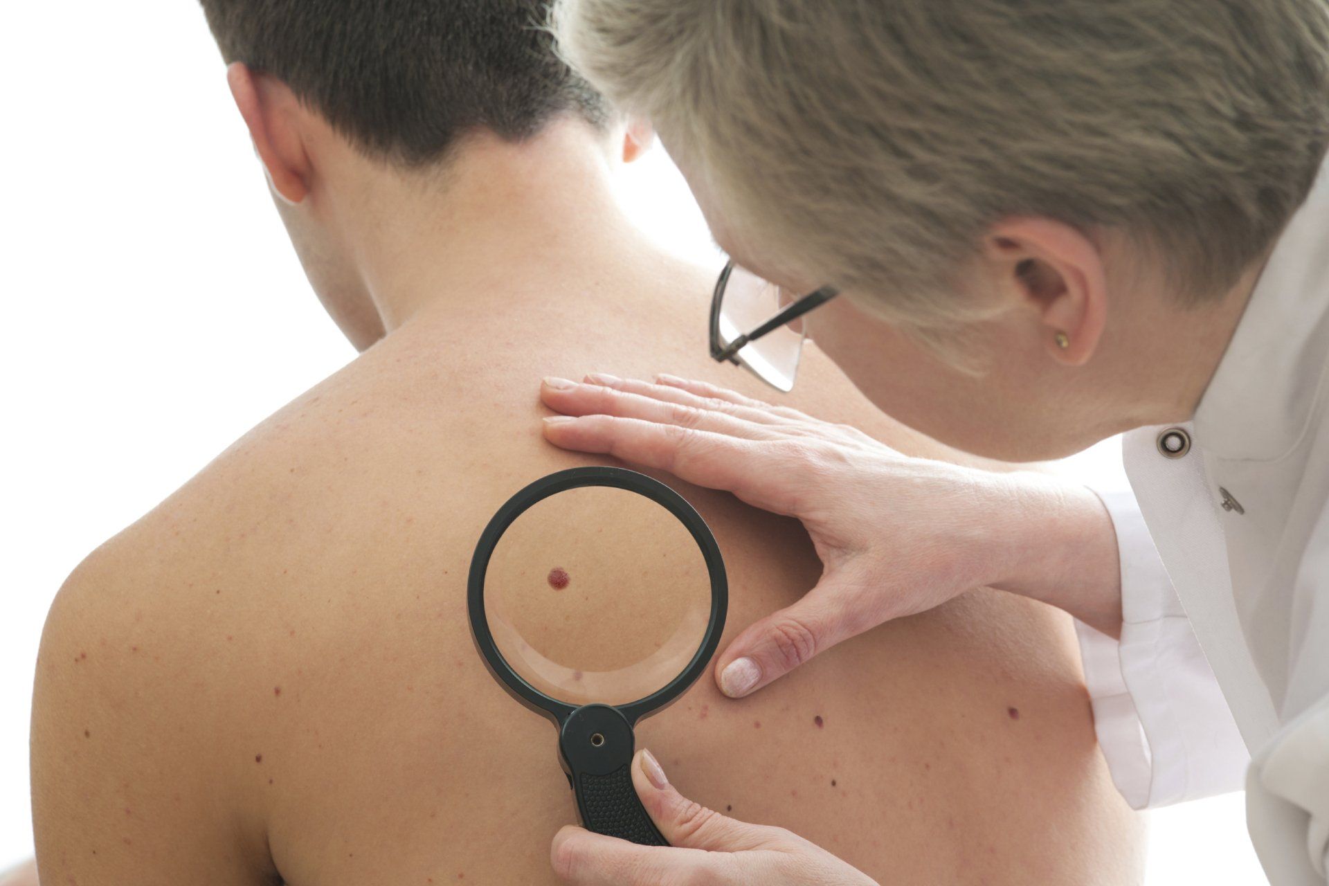 Doctor examining a mole