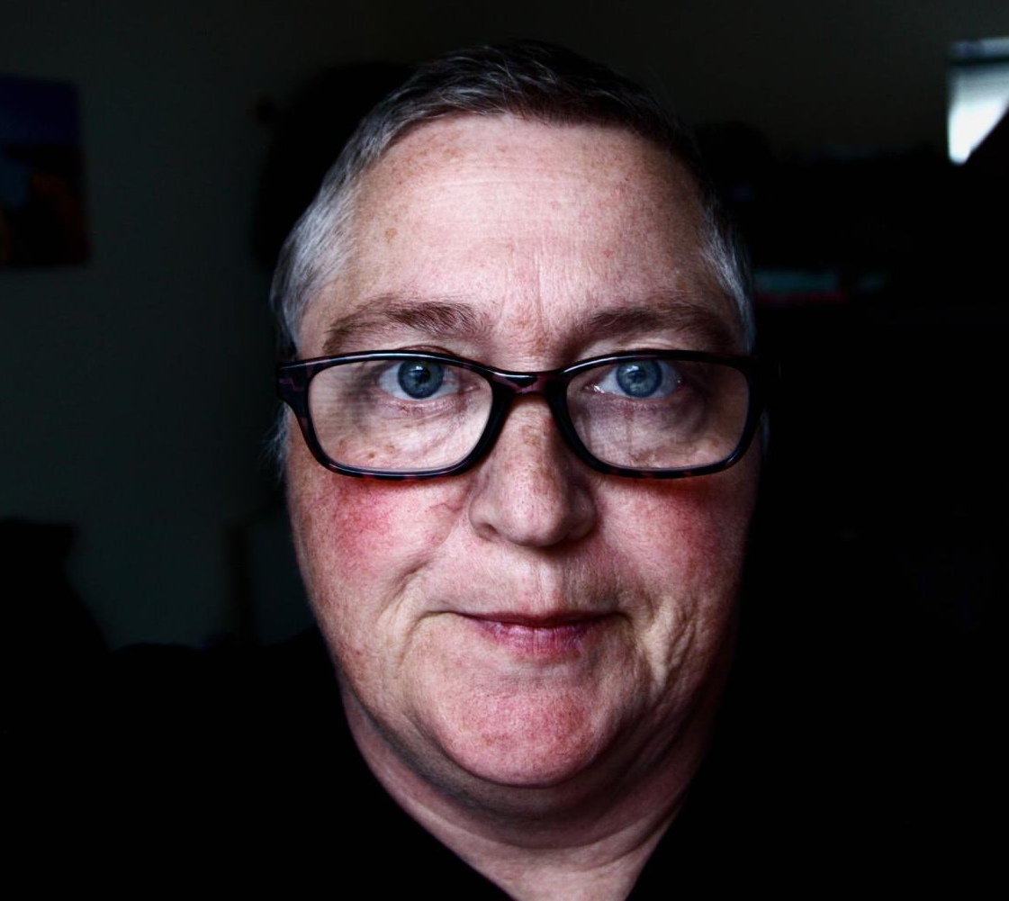 A man with rosacea